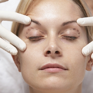 عمليات تجميل الجفون Eyelid…