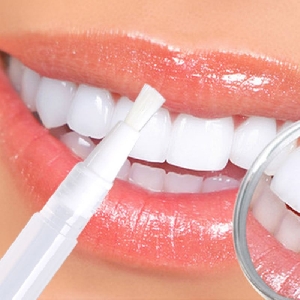 تبييض الاسنان- عروض-صيدلية…